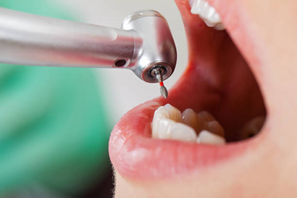 Best Pediatric Emergency Dentist in Lake Park, FL